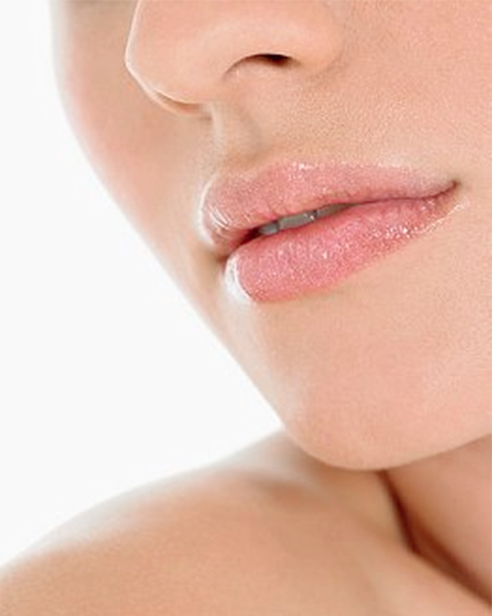 How dermal fillers can help to improve your pout