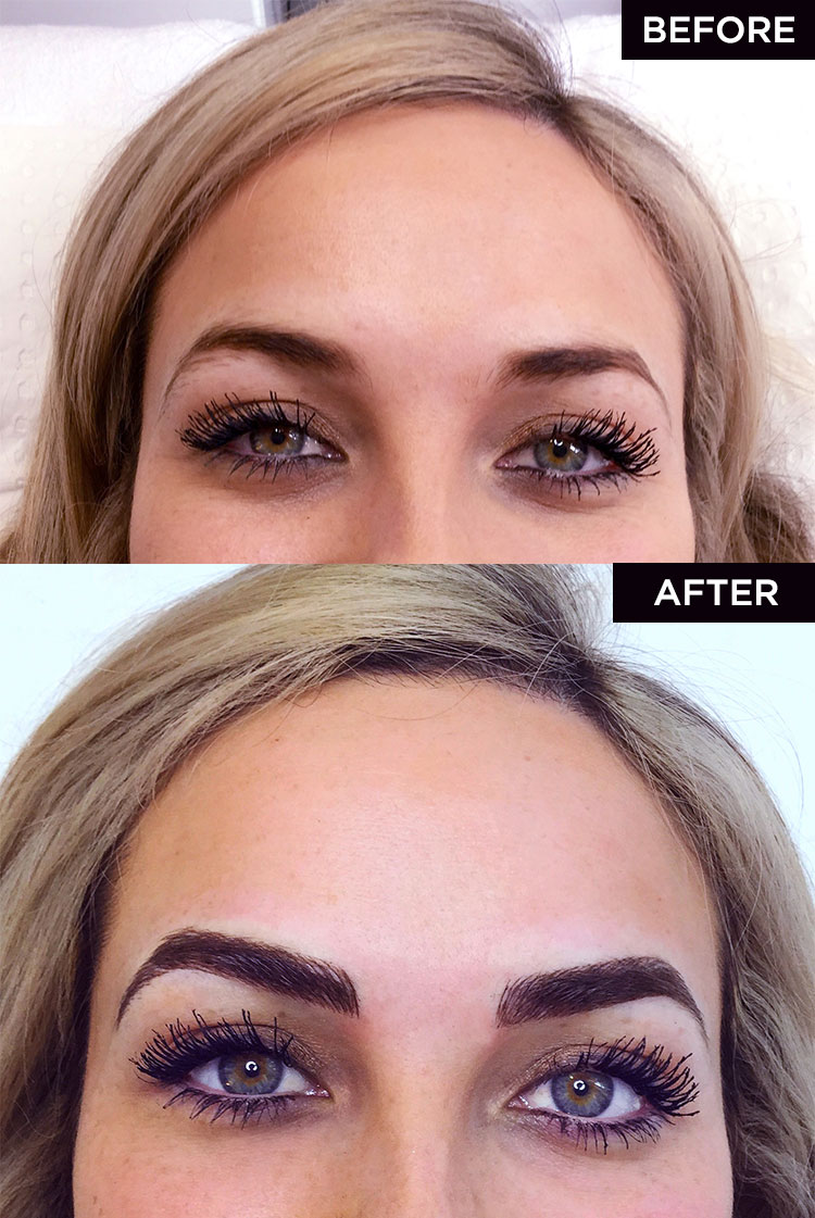 Meg's brows before and after