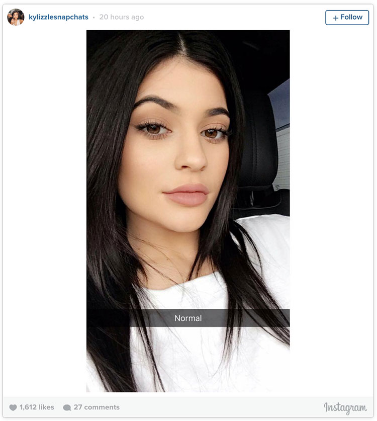 Kylie Jenner 'before' lips