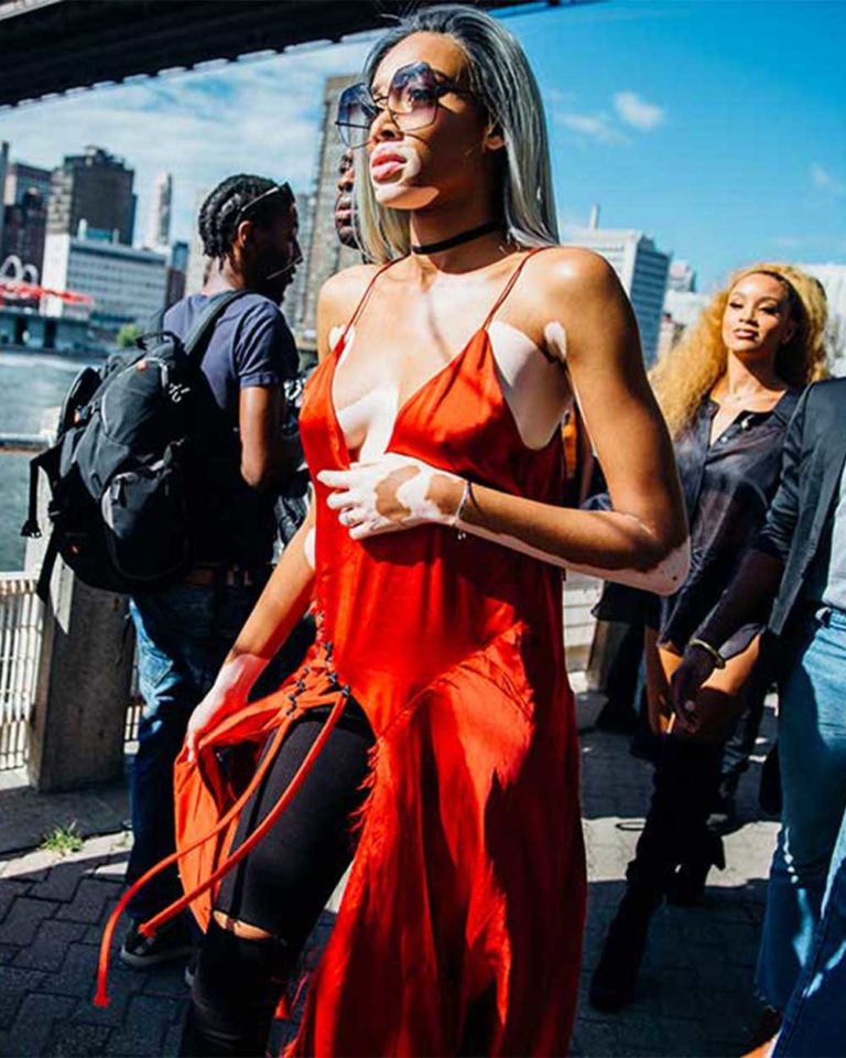 Winnie Harlow at NYFW