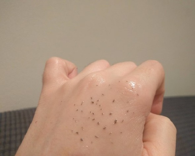 Skin grits pore extraction on hand