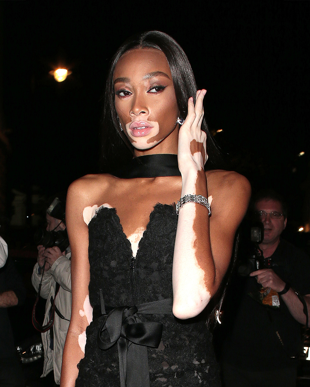 Winnie Harlow