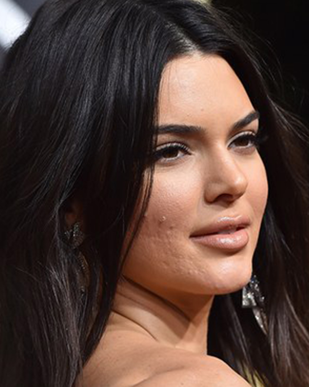 These Are The Best Cleansers For Acne Prone Skin Miss FQ