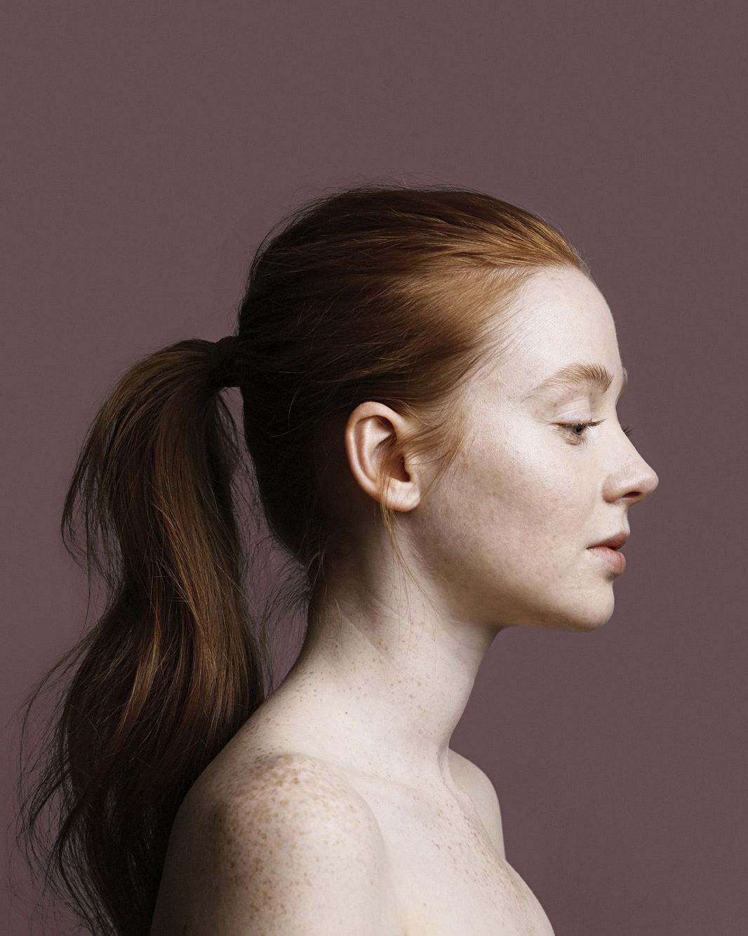 Quiz Which skin treatment is right for you? Miss FQ